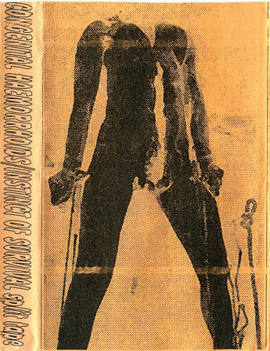 Congenital Haemorrhoids : Congenital Haemorrhoids - Instinct Of Survival